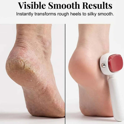 2026 Foot Grater Portable Heel Pedicure Tool