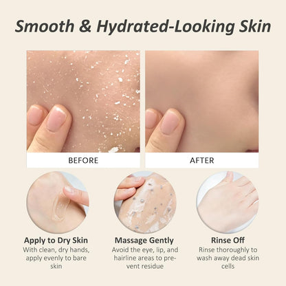 Dead Skin Remover Gel