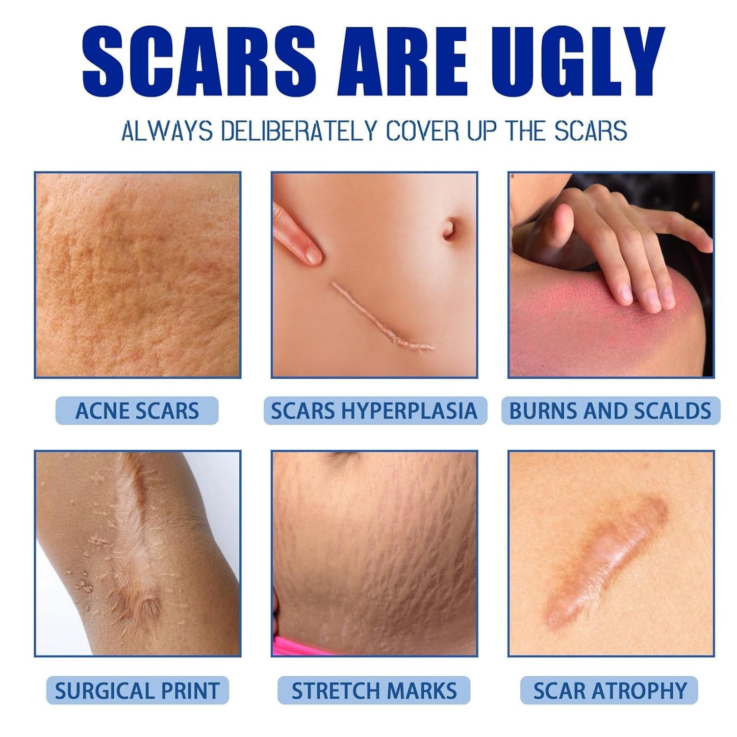 Scar Removal Cream