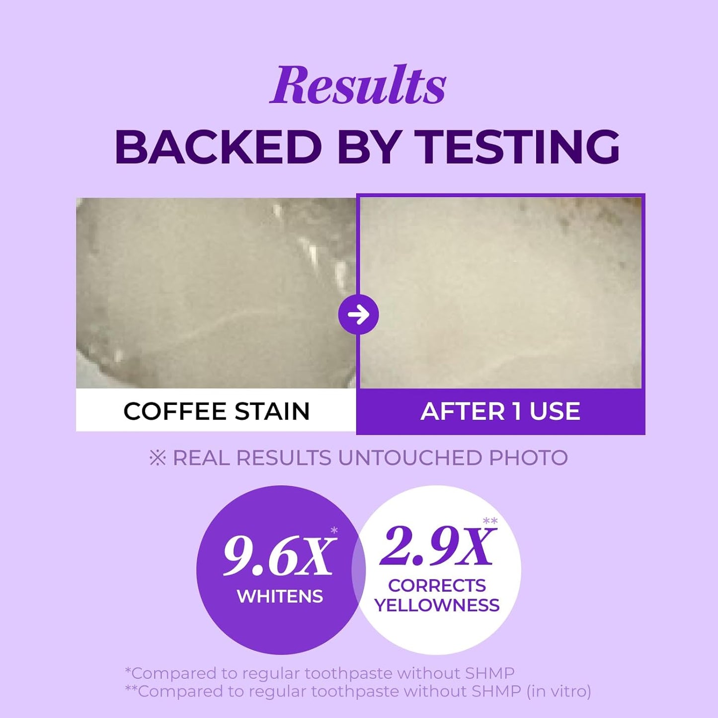 Teeth Whitening Toothpaste
